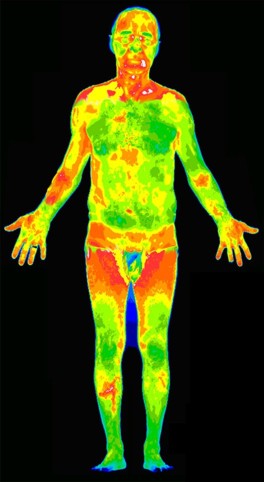 Infrared thermal image